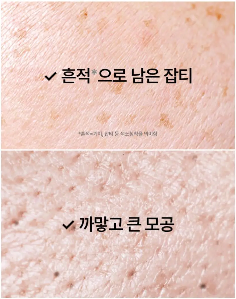 [TXA] 셀리맥스 트라넥삼산 브라이트닝 잡티 세럼 30ml 기획 (+10ml) 상세페이지 9